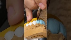 Техника нанесения керамики 10 единиц на рефракторе Noritake зубной техник dental technician
