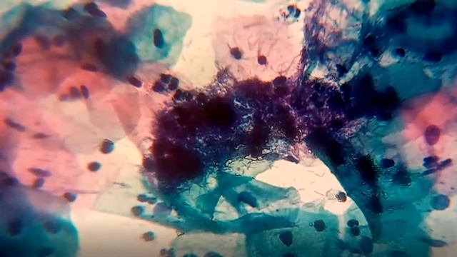 Mg. Carlos Hugo García Vásquez Especialista en Citología Actinomyces смотреть онлайн