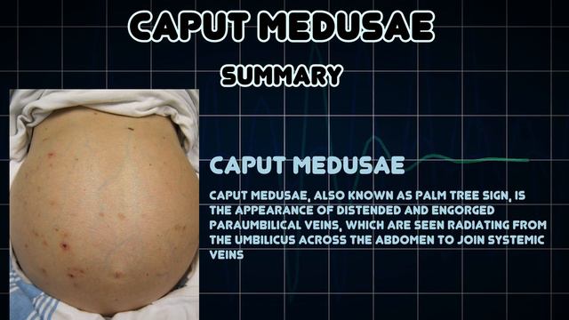 Caput medusae (Medical Condition) смотреть онлайн