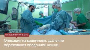 Хирургическое лечение рака ободочной кишки