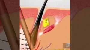 ФАЗЫ РОСТА РЕСНИЦ!