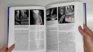 Рогацкин Д.В. - Лучевая диагностика в стоматологии: 2D/3D