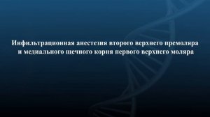 Инфильтрационная анестезия  в стоматологии