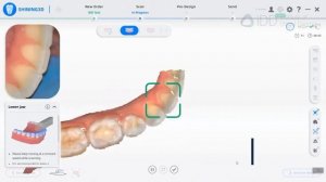Shining3D Aoralscan 3 (Wireless)  Basic Training Webinar Part 4