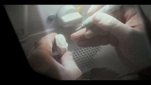 Виниры от А до Б. Как сделать зубы за 1.000.000 рублей. Часть: 5