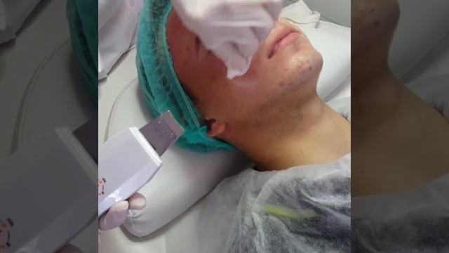 Ультразвуковая чистка лица