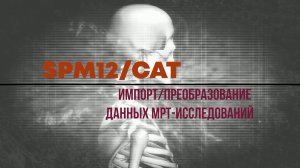 002. SPM12/CAT. Импорт DICOM-файлов. Преобразование в NIfTI-формат.
