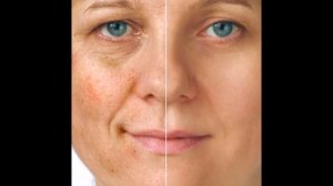 Убрать пигментные пятна ЛЕГКО, нужно просто...