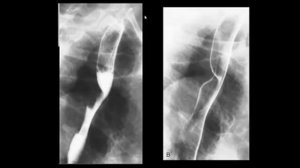 GIT imaging review case Dr. Amr Saadawy