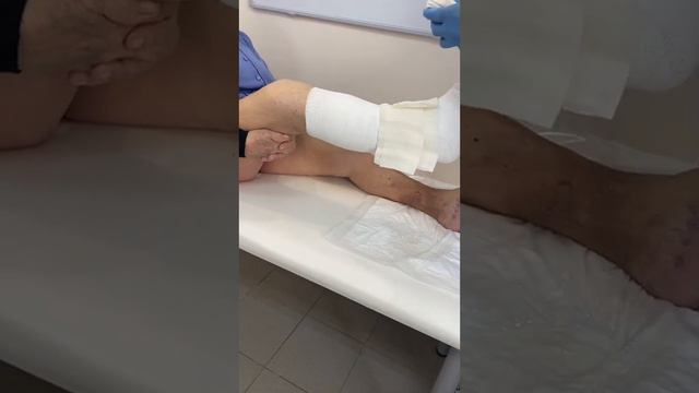 Ещё раз о технике бандажирование я ноги цинковым бинтом при трофической язве и отеке. Якушкин Серге
