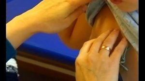 Атопический дерматит