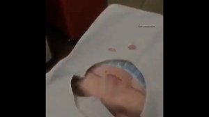 Гигантские прыщи, огромный угри/pustules, pimples, blackheads and black dots