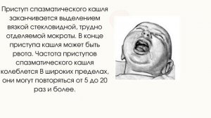 Коклюш у детей.