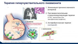 Черняк на Пульмоконгрессе 2021