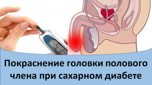 Покраснение головки полового члена при сахарном диабете