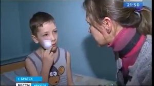 В Братске домашняя собака напала на семилетнего мальчика Из за травмы лица он оказался в больнице