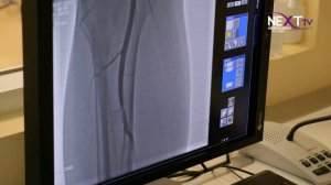 В Нефтекамске провели сложную операцию.