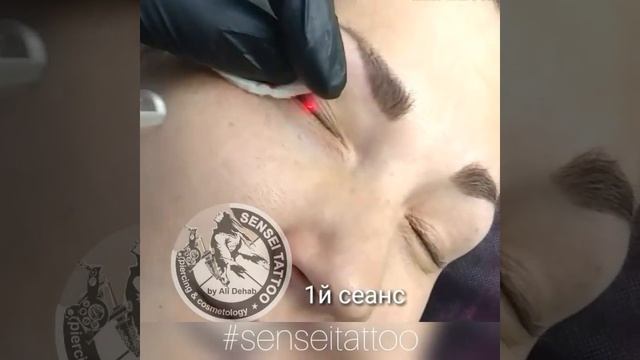 Удаление некачественного татуажа век (стрелок) в Днепре