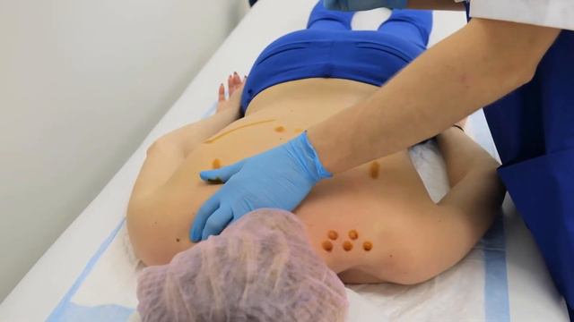 Выполнение процедуры RANC