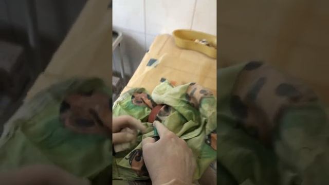 Удаление кефалогематомы.