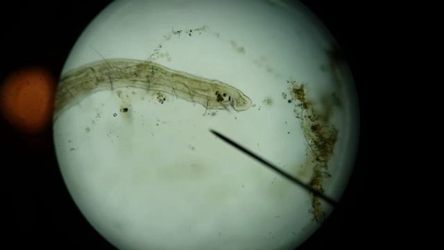 Naididae Freshwater Flatworm 3