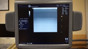 GE Logiq 7 обзор ультразвукового сканера