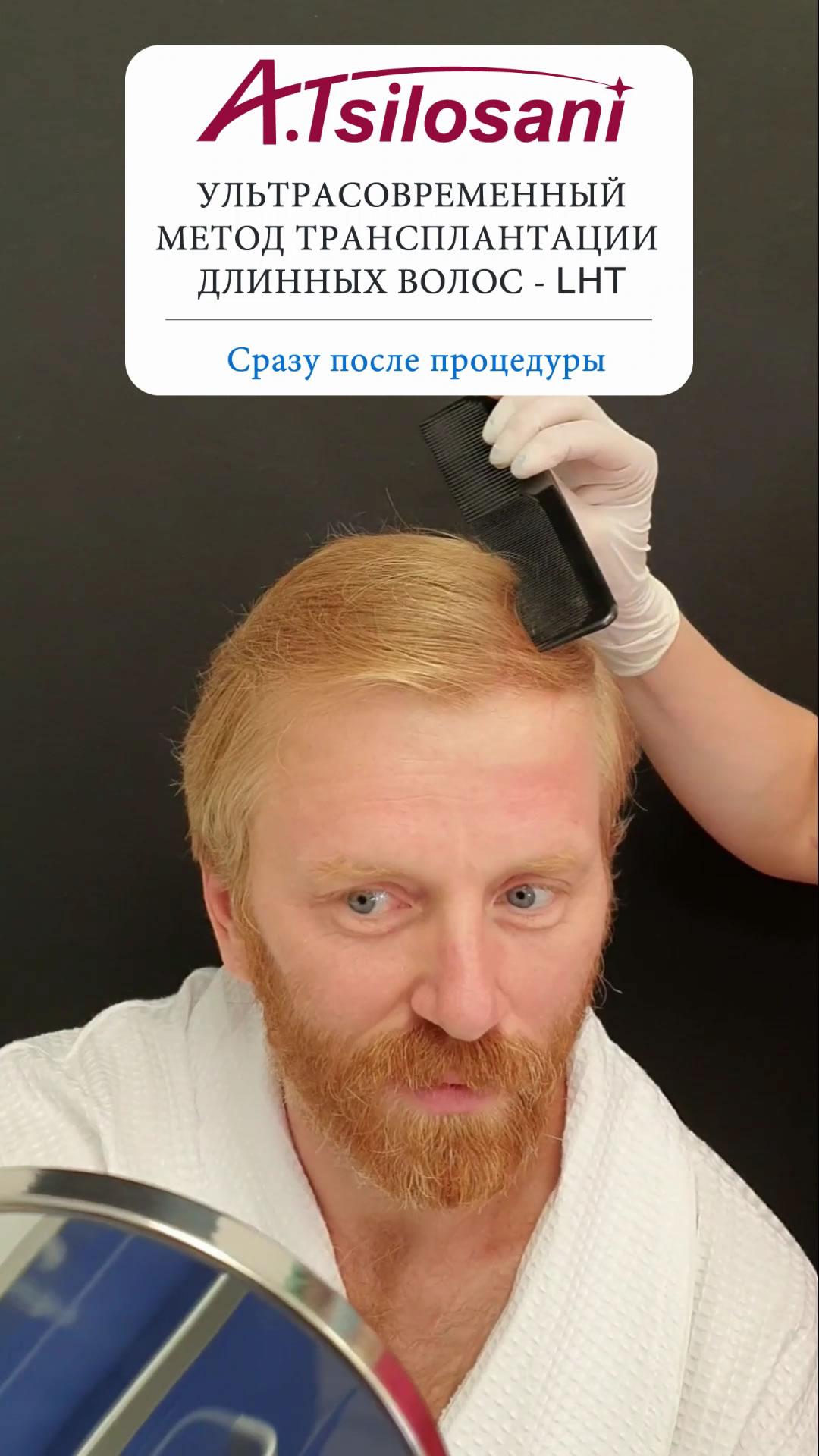 длинная пересадка