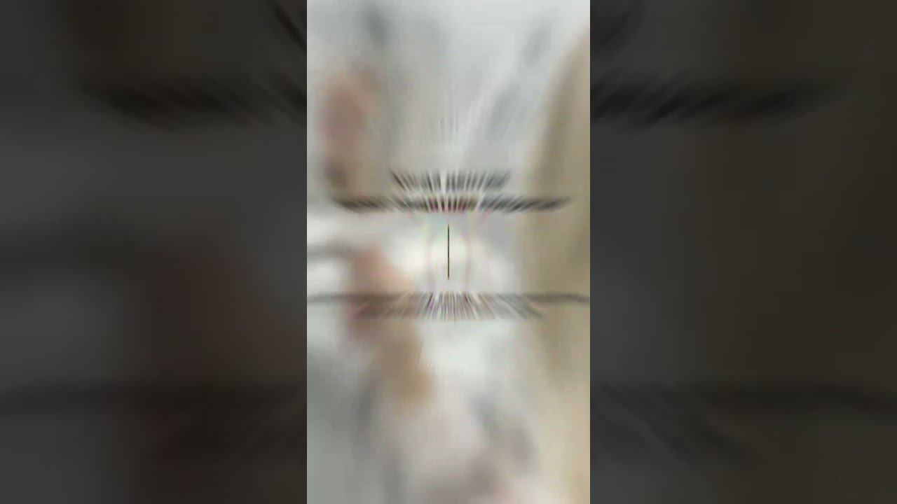 Чувствительность зубов #зубы #shortvideo #стоматолог #shots #клиника