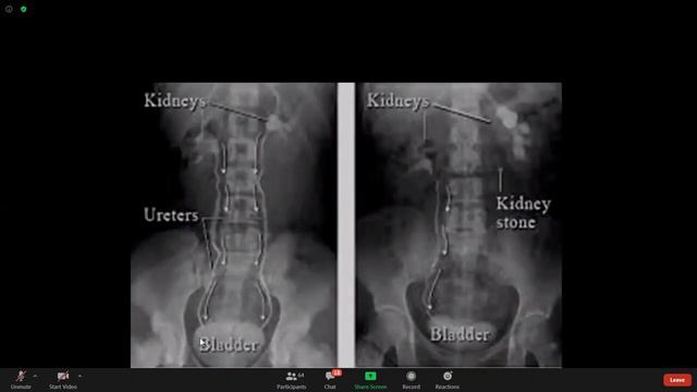 UroRadiology (Practical) смотреть онлайн