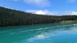 Lake Louise Amazing View | Lake Louise Trip | Lake Louise Canada