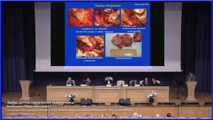 Выбор доступа при опухолях надпочечников Ромащенко Павел Николаевич