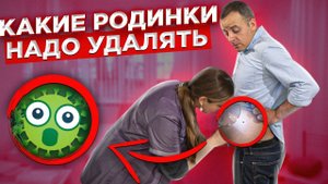 Как распознать опасные родинки?