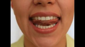 Артикуляционная гимнастика часть 9