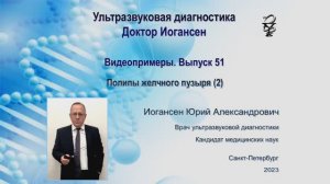 Ультразвуковая диагностика. Доктор Иогансен. Видеопримеры. Выпуск 51. Полипы желчного пузыря (2).