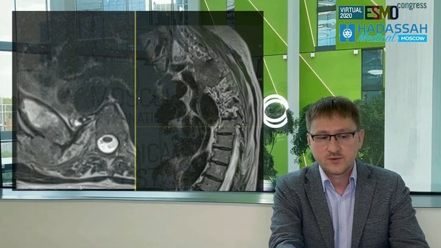 Лучевая терапия | итоги ESMO 2020 смотреть онлайн