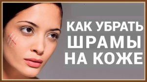 КАК УБРАТЬ ШРАМЫ НА КОЖЕ