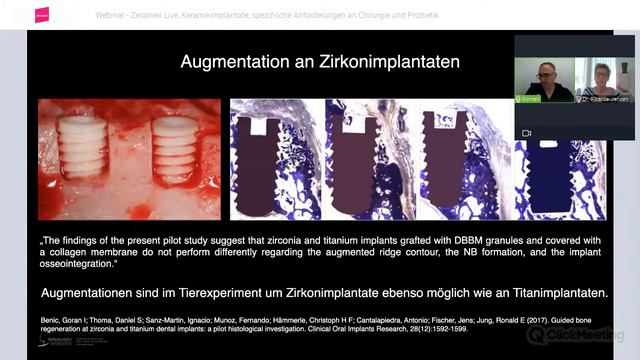 Keramikimplantate: Spezifische Anforderungen an Chirurgie & Prothetik. Erfahrungen