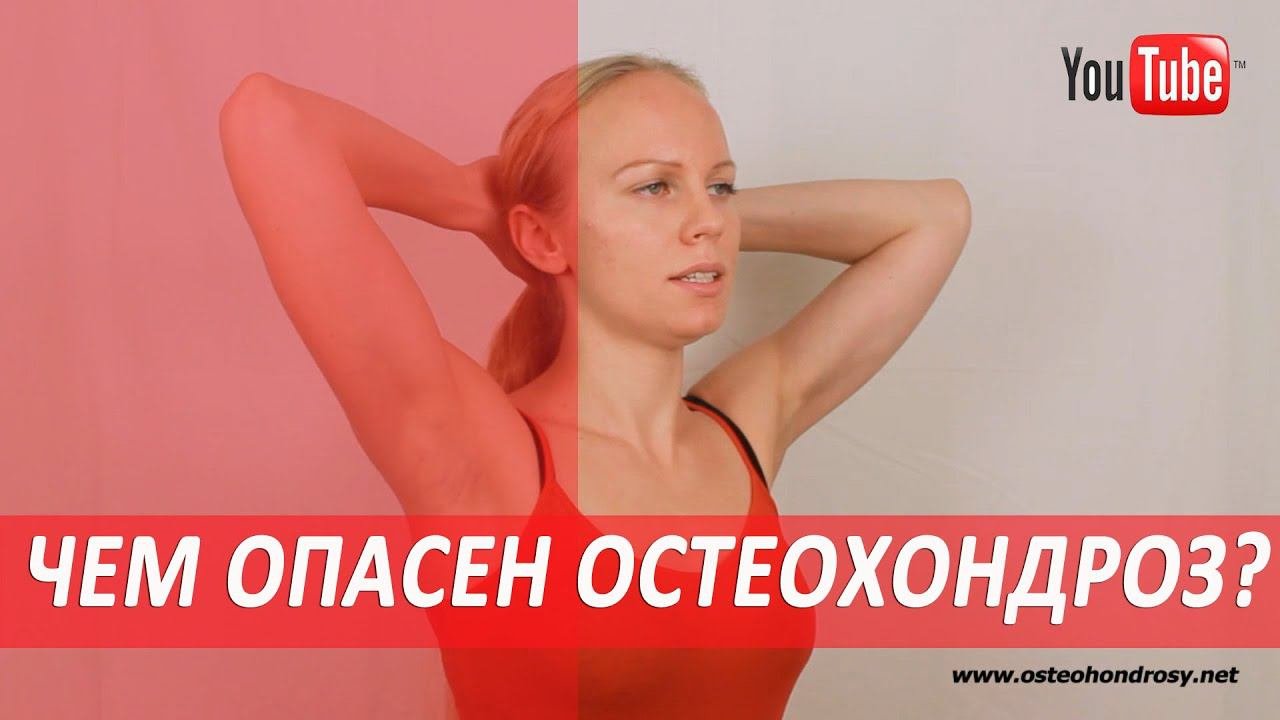 ►ЧЕМ ОПАСЕН ОСТЕОХОНДРОЗ?  [Последствия остеохондроза]
