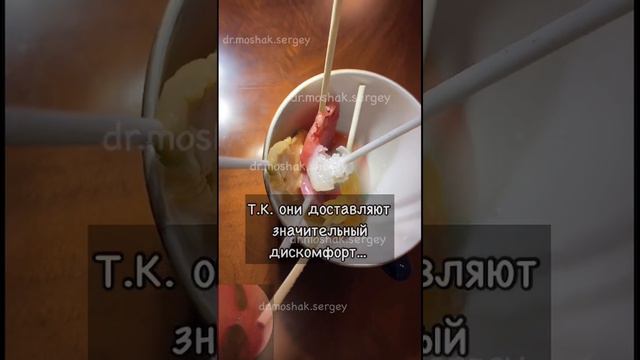 Синехии в носу смотреть онлайн