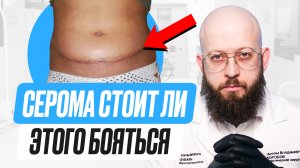 Что такое серома? Почему возникает серома? Профилактика серомы после пластической операции