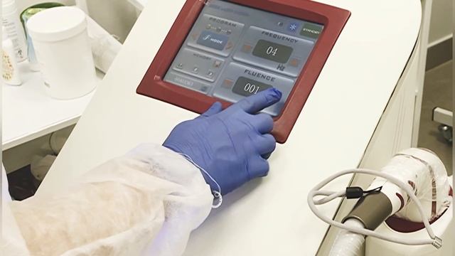 Лазерная эпиляция смотреть онлайн