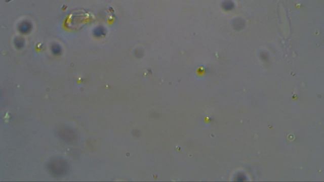 Рост верёвочного червя в среде витамина B комплекс Seilwurm mit Vitamin B - Komplex Wachstum смотреть онлайн