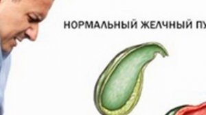 Хронический холецистит симптомы причины профилактика