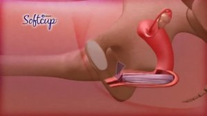 Как использовать Softcup