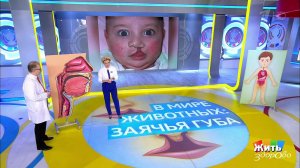 Заячья губа. Как исправить дефект? Жить здорово! Фрагмент выпуска от 12.03.2019