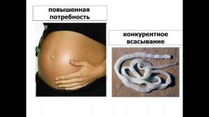 Лекция 04.
Леч_Педфак.
Анемии. Полная.