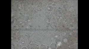 Бластоцисты в кале