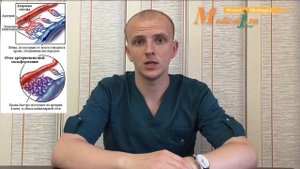 Артериовенозная мальформация. Причины, симптомы, лечение АВМ