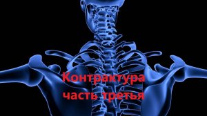 КОНТРАКТУРА. Часть 3. Чем чревата пассивная разработка контрактур...