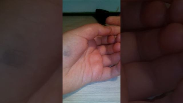 Я сломала палец!!!?